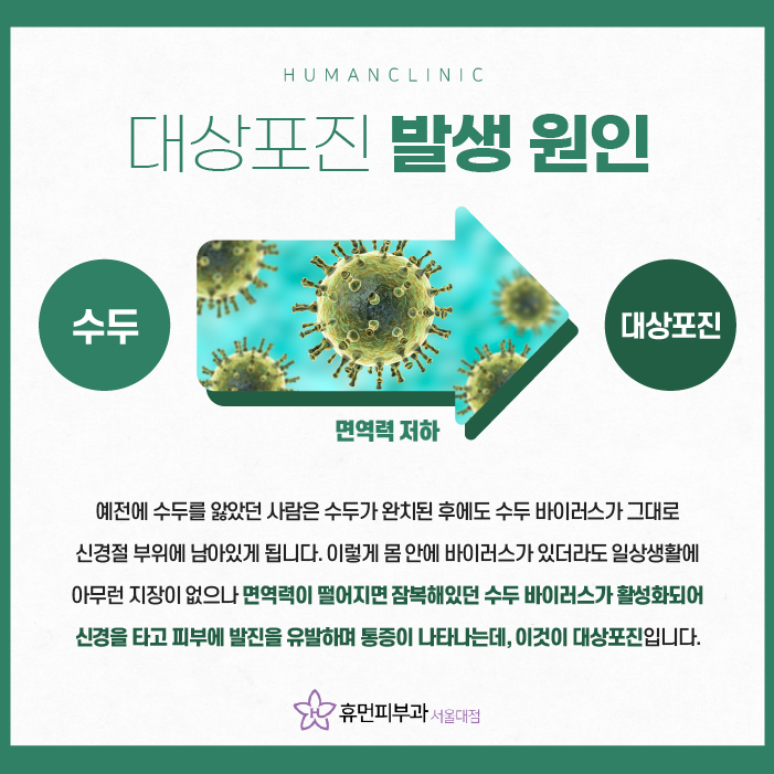 대상포진전염성 예방접종이 효과 있을까? 관련 이미지 3