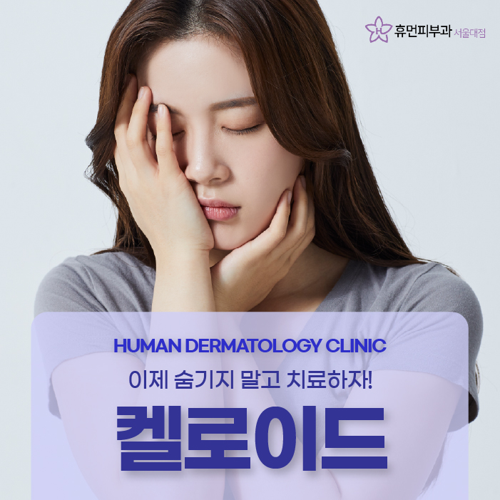 장승배기피부과 켈로이드 알아보려고 한다면? 관련 이미지 1