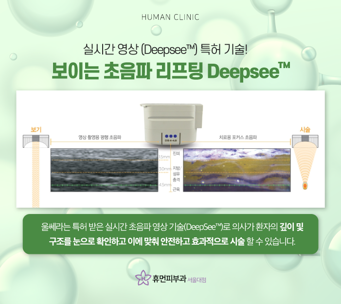 문래동피부과 울쎄라가격 효과로 주름 없는 얼굴 동안 이미지 만들어보자 관련 이미지 7