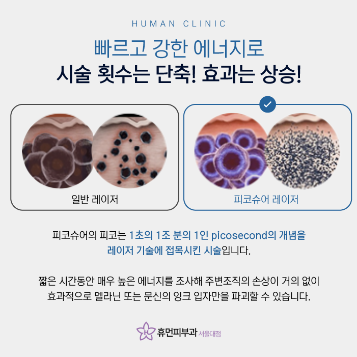 문신지우는법 잉크와 멜라닌만 선택적으로 제거 관련 이미지 3