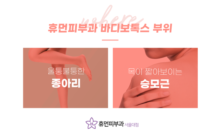 사당피부과 매끈한 바디라인을 위해서 관련 이미지 3