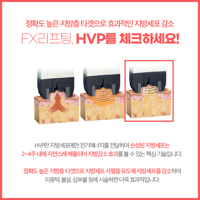 서울인모드 FX 모드로 갸름하게 관련 이미지 4