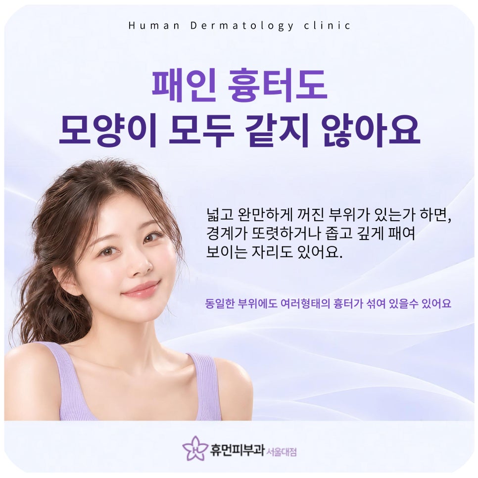 상도피부과 여드름흉터, 깊이만 보고 치료하지 않아요 관련 이미지 4
