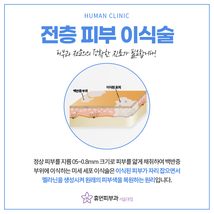서울대입구역피부과 백반증 고민된다면? 관련 이미지 8