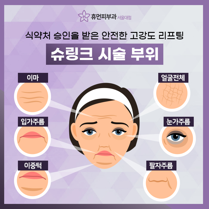 슈링크300샷효과 어떤 게 있을까? 관련 이미지 3