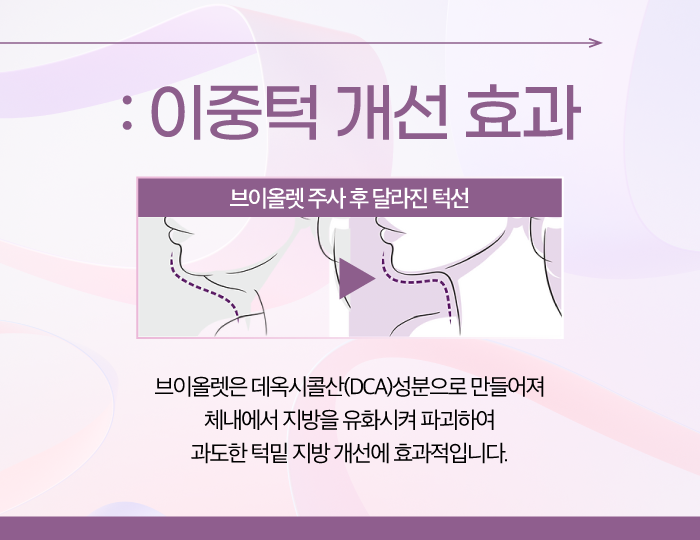 V라인주사 브이올렛으로 이중턱 고민은 이제그만 관련 이미지 3