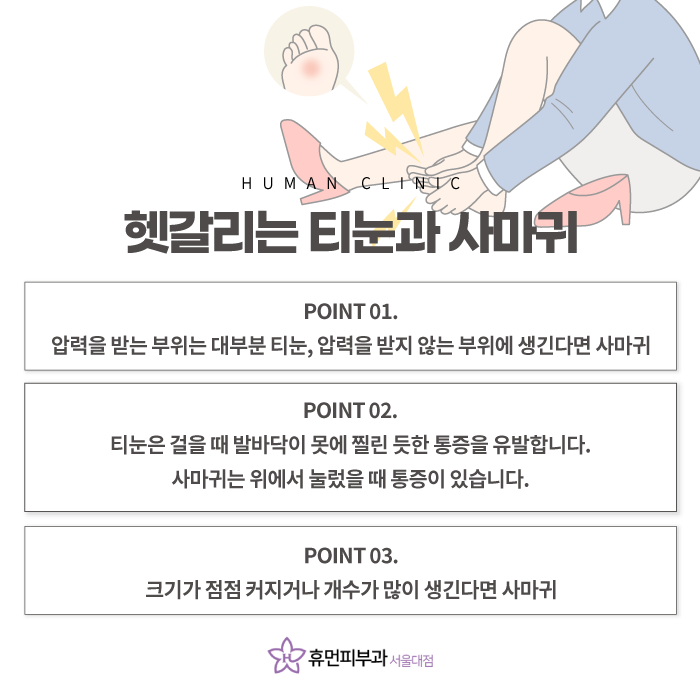 상도역피부과 티눈 정확한 진단으로 관련 이미지 3