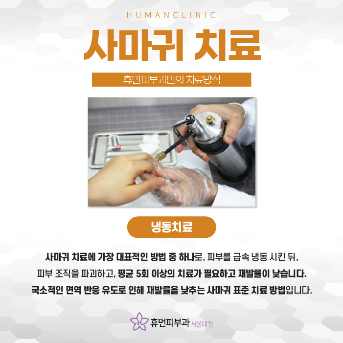 사당역피부과, 사마귀 관리 꼼꼼하게 하려면? 관련 이미지 7