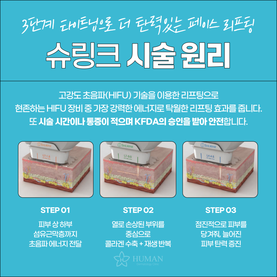 서울대입구슈링크? A부터 Z까지 전부 알려드립니다. 관련 이미지 5