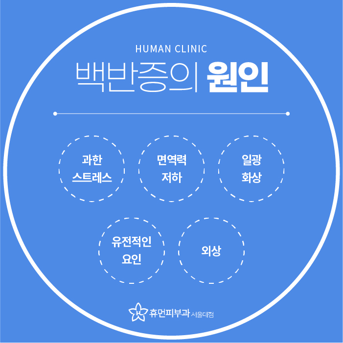 서울대입구역피부과 백반증 고민된다면? 관련 이미지 3