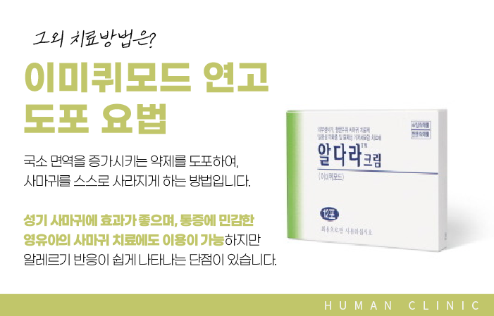서울대역피부과 사마귀치료 더 심해지기 전에 관련 이미지 12