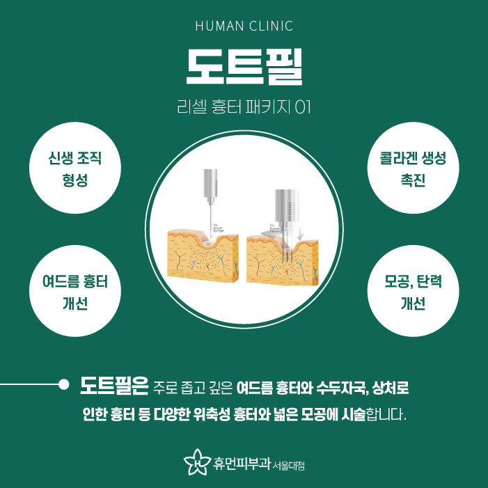 중앙대피부과 여드름파인흉터 확실하게 치료하려면? 관련 이미지 4