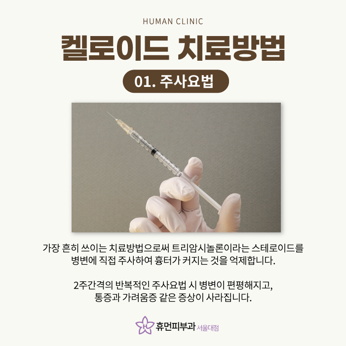 켈로이드피부과 어떻게 치료하나요 관련 이미지 4