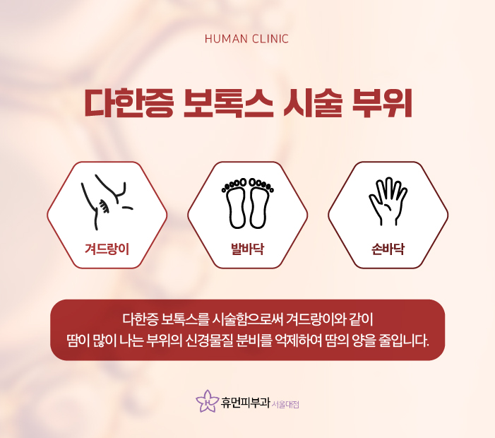 다한증보톡스로콤플렉스 해결하기 위해서는? 관련 이미지 5