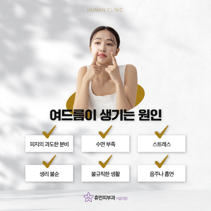 서울대입구역피부과 피부과여드름치료 여드름피부관리 해도 재발한다면 모공 수축과 피지선 제거를 통해 관련 이미지 2
