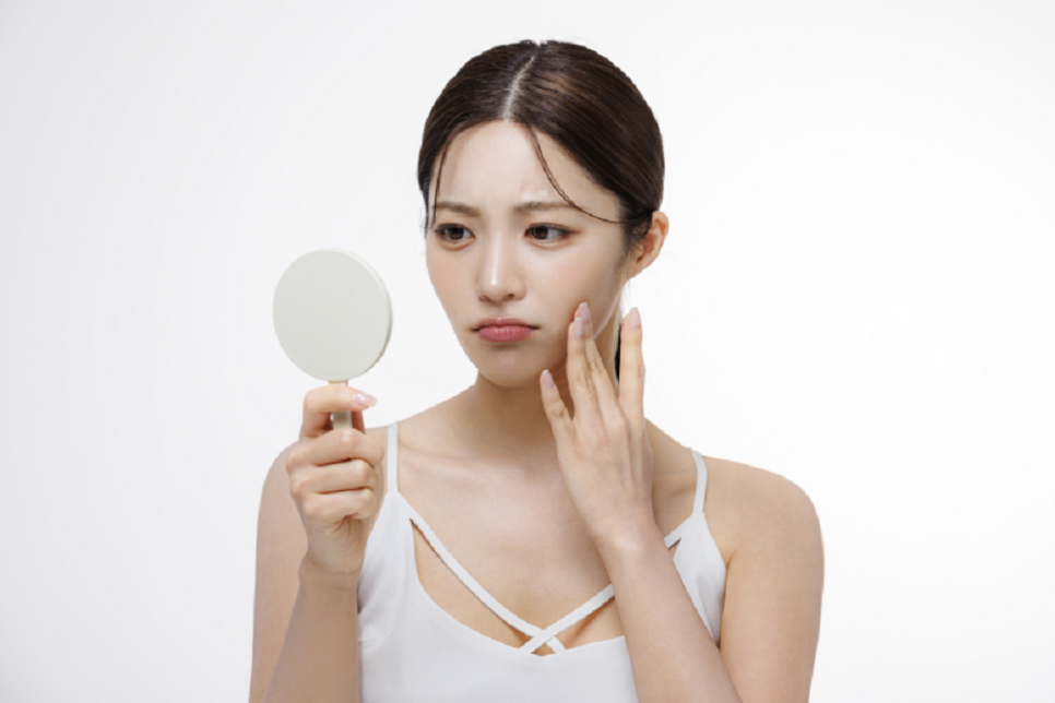 Can Summer Acne Be Dismissed as Simple Pimples? image 1