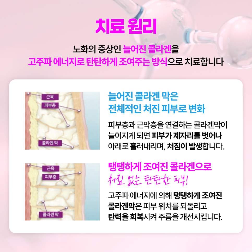 Nakseongdae Station Dermatology: If You Could Get Only One Treatment for Early 30s Skin Care, What Would It Be? image 4