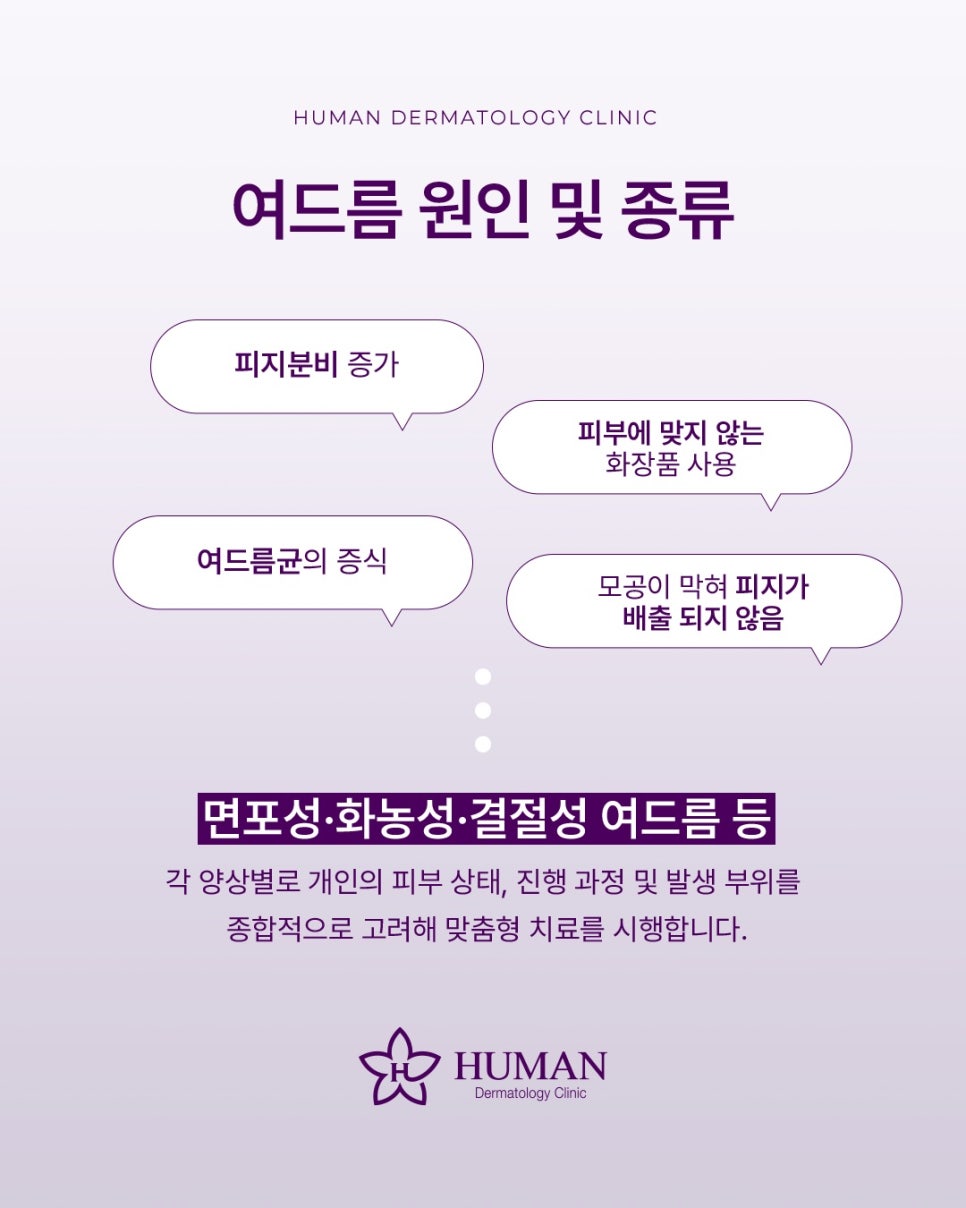 Why You Should Start Acne Treatment at Seoul National University Entrance Only After Understanding It Properly image 3