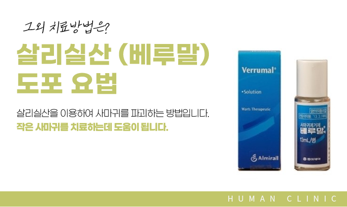 서울대역피부과 사마귀치료 더 심해지기 전에 관련 이미지 13