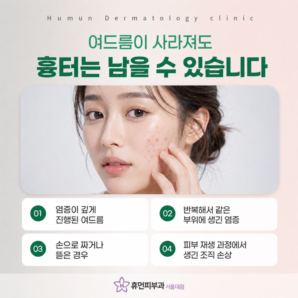 Acne Scars at a Seoul National University Station Dermatology Clinic: Treatment Tailored to Skin Type and Scar Depth image 3