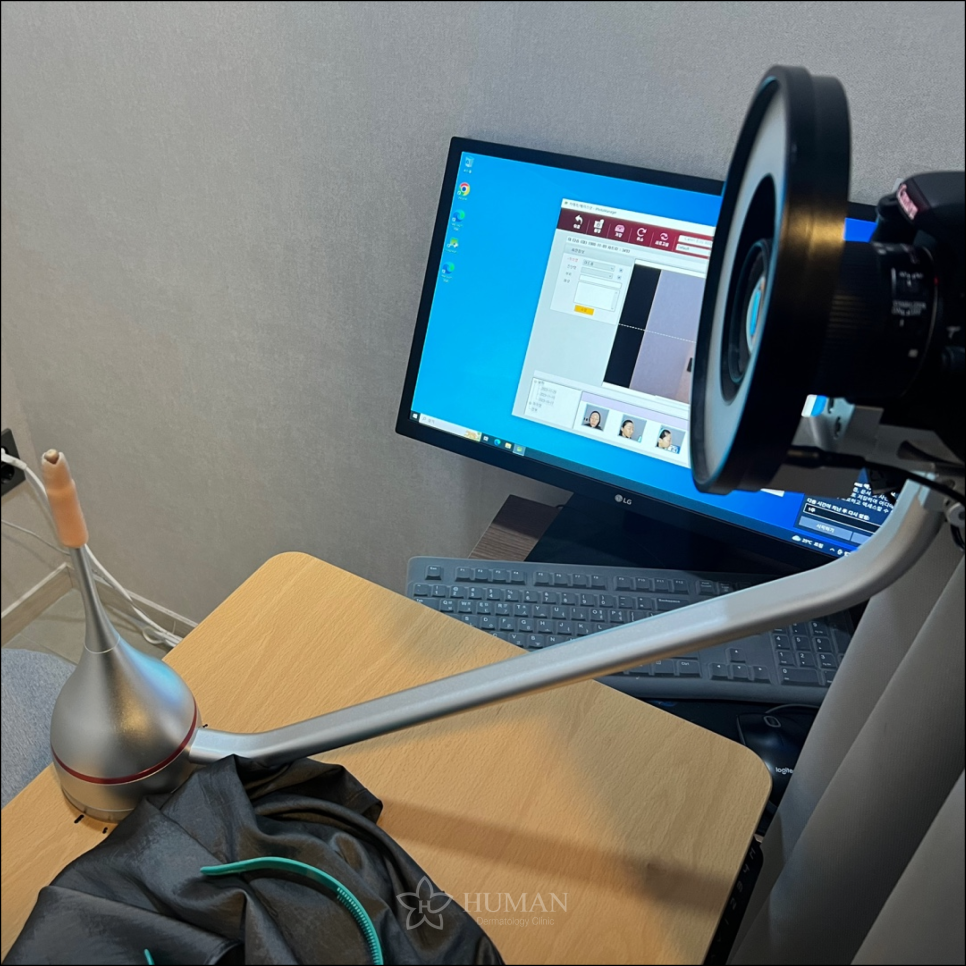 서울대입구역피부과 실리프팅 비용? 00만원이면 됩니다. 관련 이미지 4