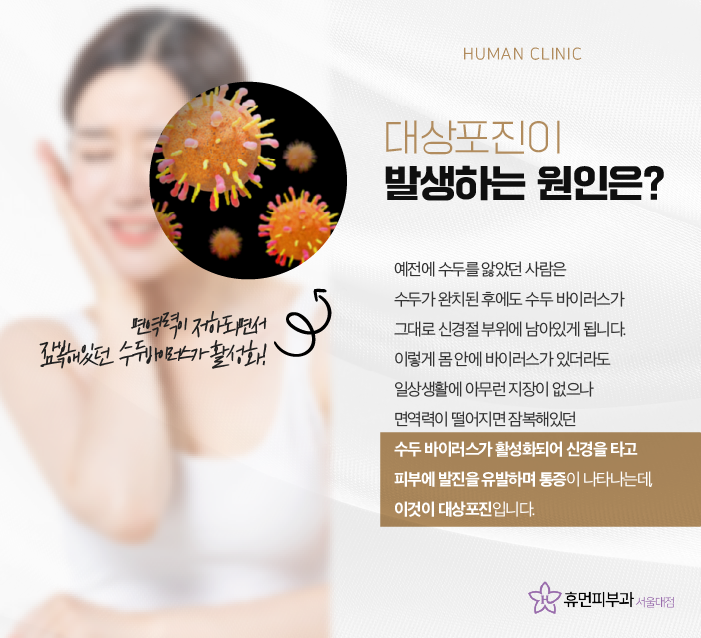 구로디지털단지피부과 대상포진병원 대상포진초기증상 바로 알고 빠른 시기 내에 회복을 관련 이미지 3