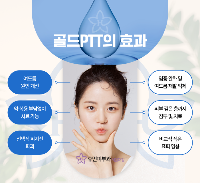 골드PTT가격만 고려하기 보다 피부 상태에 따라 관련 이미지 5