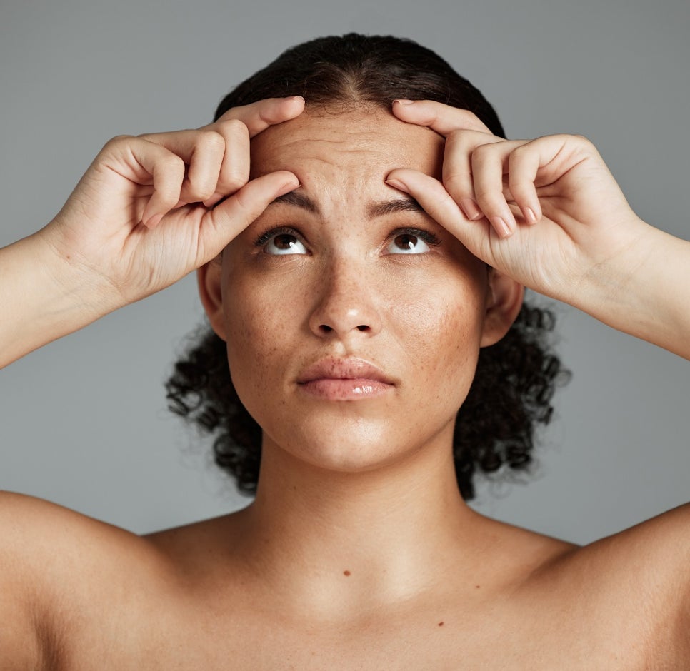 How to Manage Forehead Wrinkles Before They Deepen image 4