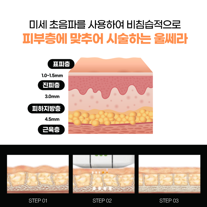 울쎄라잘하는곳 피부과전문의가 진행하는 휴먼피부과 서울대점 관련 이미지 5