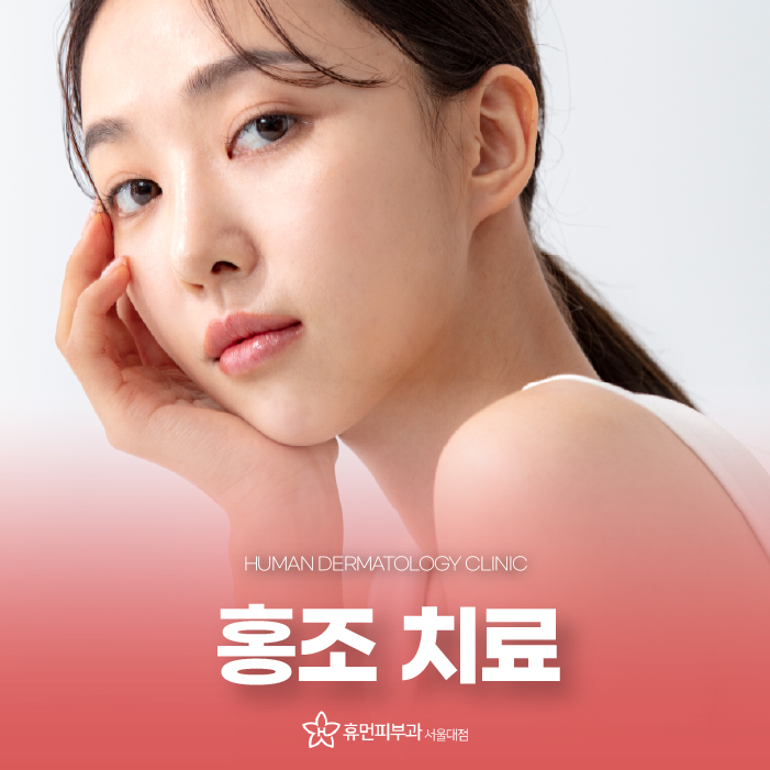 서울대입구피부관리 피부과홍조 고민으로 스트레스 받으면 악화될 수 있어요 관련 이미지 1