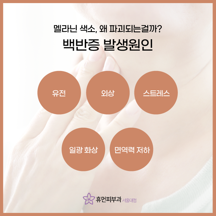 서울피부과추천 백반증은 어떻게 치료할까요? 관련 이미지 3