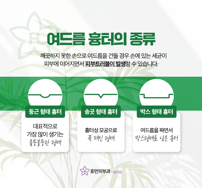 신림피부과 여드름흉터 지우는 방법은? 관련 이미지 2