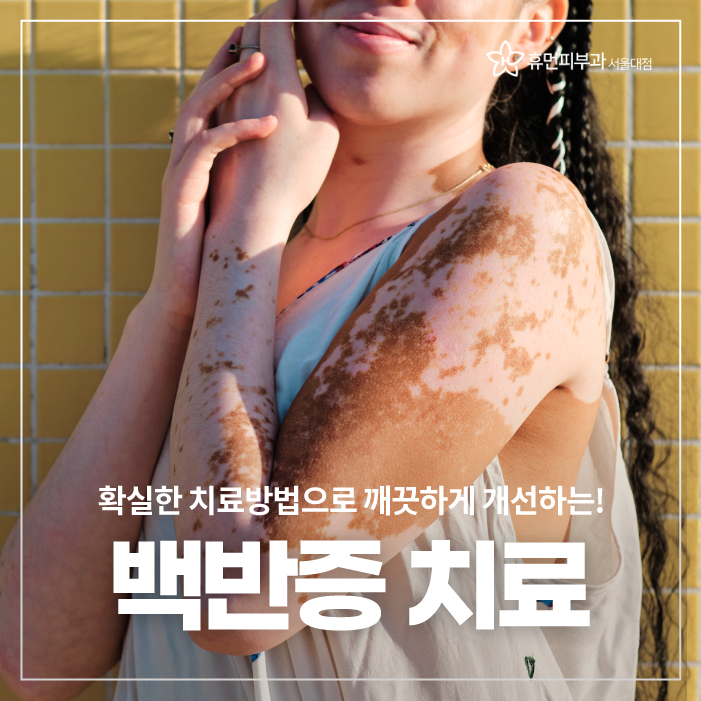 흑석피부과 백반증 포기하지 마세요 관련 이미지 1