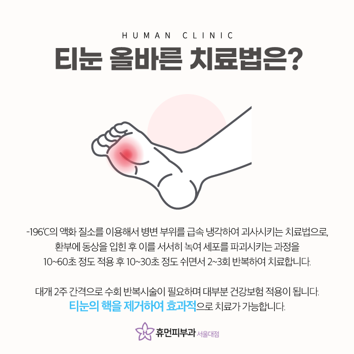 상도역피부과 티눈 정확한 진단으로 관련 이미지 5