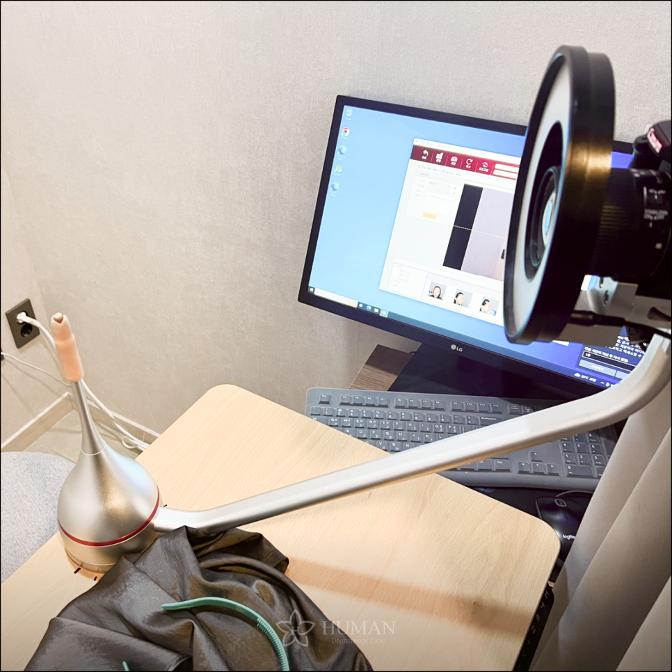 Nakseongdae Dermatology: How Can We Solve the Pigmentation Problems Left on the Face? image 4