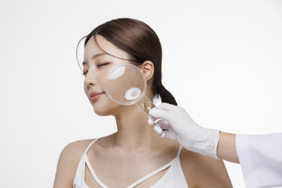 Can Summer Acne Be Dismissed as Simple Pimples? image 4