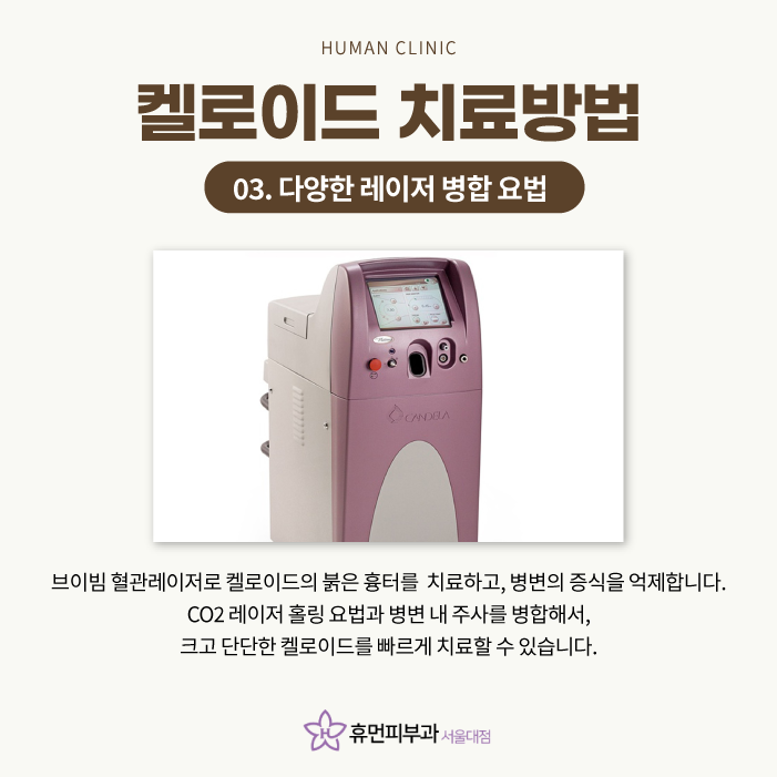 켈로이드피부과 어떻게 치료하나요 관련 이미지 6