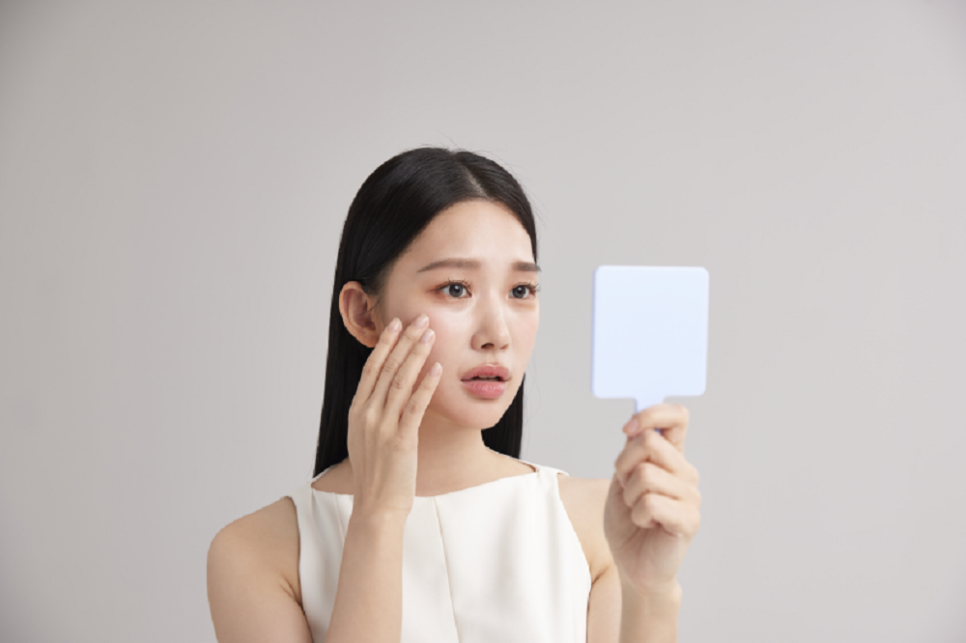 Will Acne Scars Naturally Improve Over Time? image 6