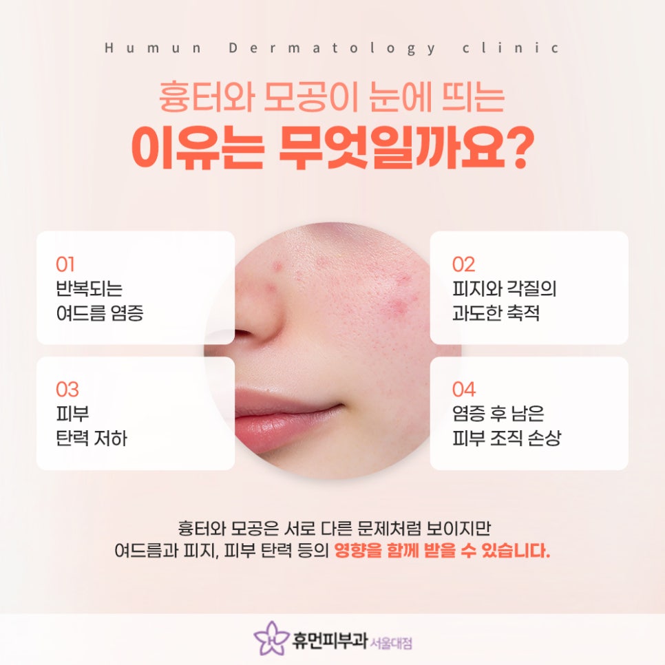 상도피부과 흉터와 모공 함께 진단해야 하는 이유 관련 이미지 3