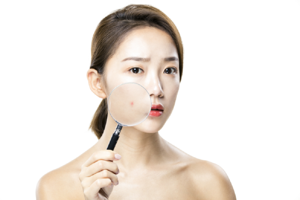 Why Breakouts Around the Mouth & Jaw Keep Recurring image 2