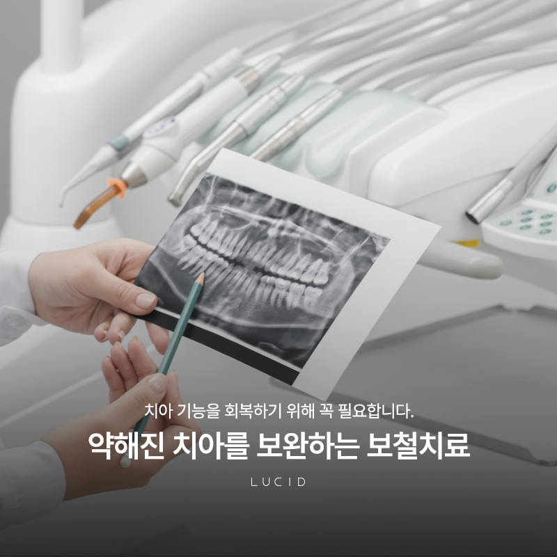 Understanding Prosthetic Dental Treatment in Seocho-dong image 2