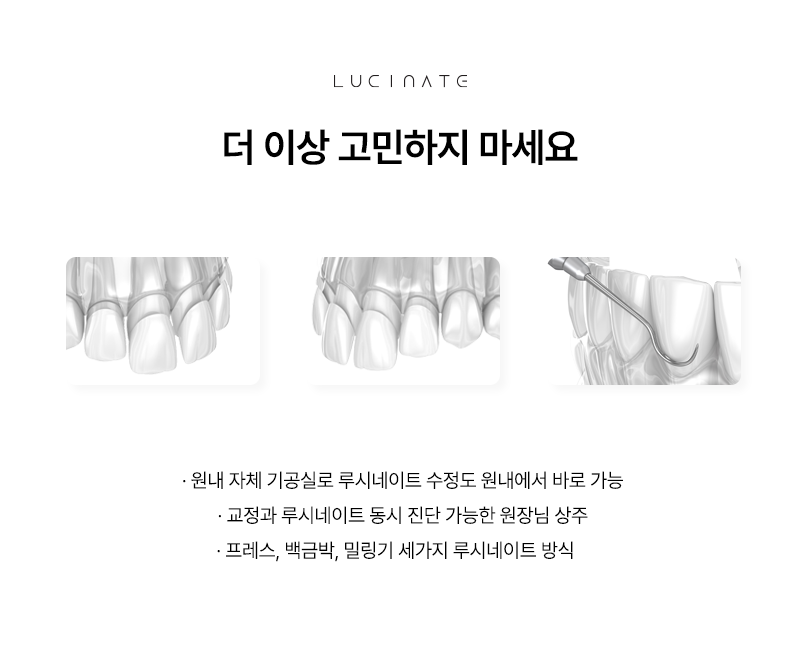 강남치과 루시네이트 치아 라인의 중요성 관련 이미지 4
