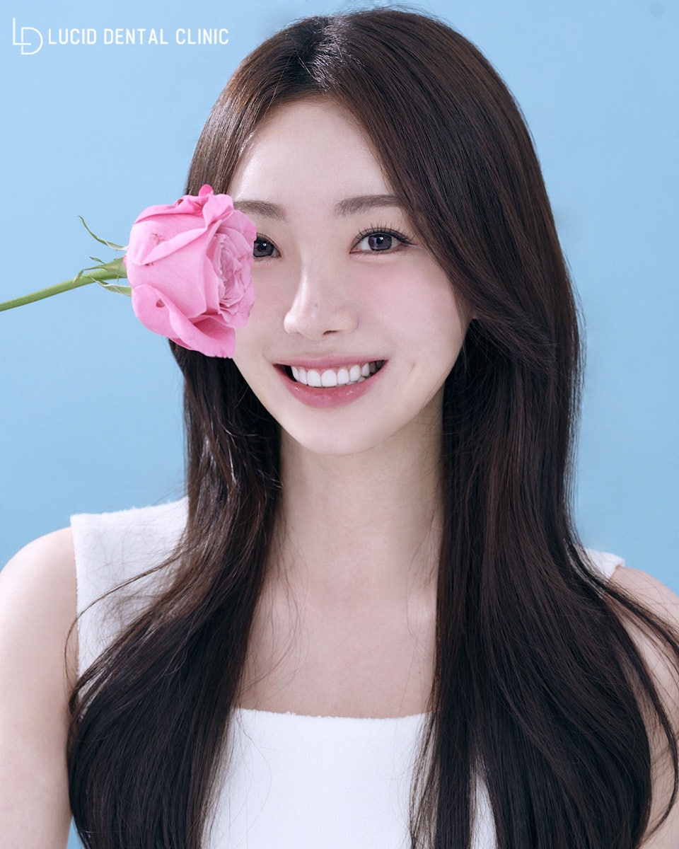 "앞니 크기가 달라 보여요." 논현동 치과 루시네이트로 깔끔한 변신 관련 이미지 1