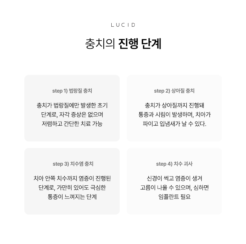 역삼동치과 어린이 충치, 방치하지 마세요 관련 이미지 4