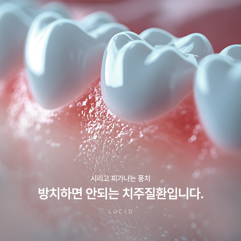 논현동치과 풍치 증상 및 원인 예방법까지 총정리 관련 이미지 1