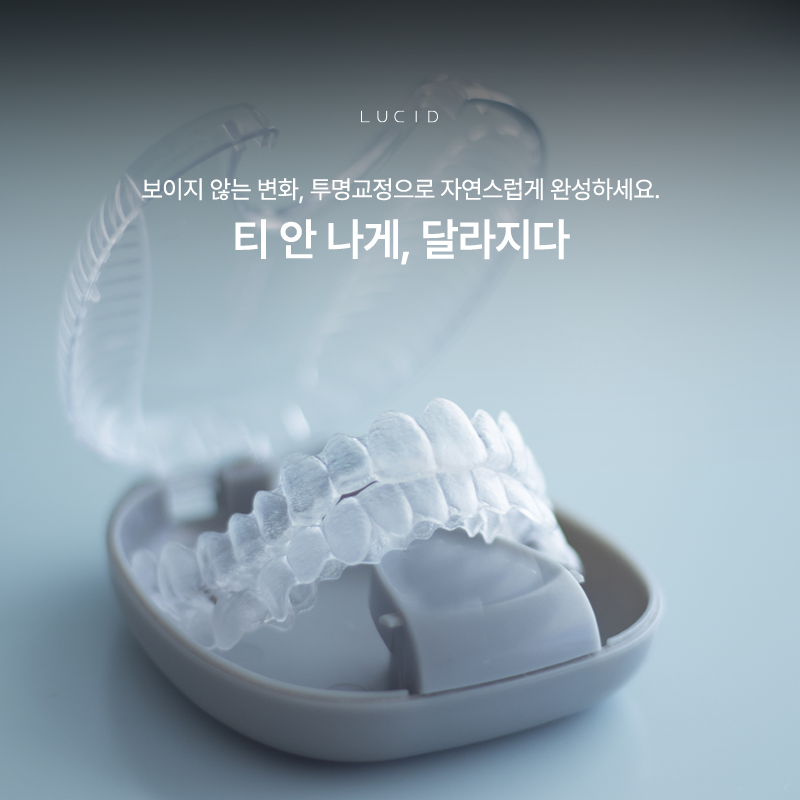 How Much Can You Expect from Clear Aligner Treatment? image 2
