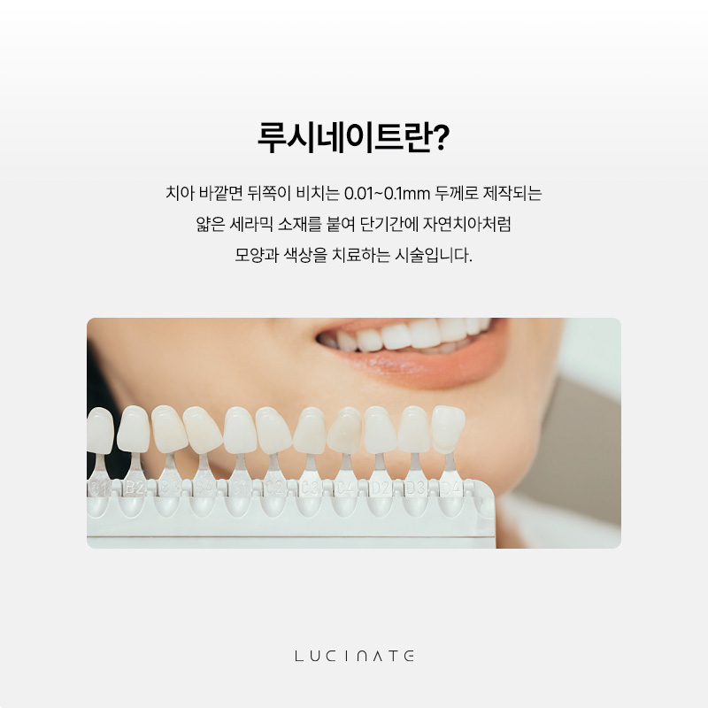 Precautions for Lucinate to Protect Your Own Smile image 2