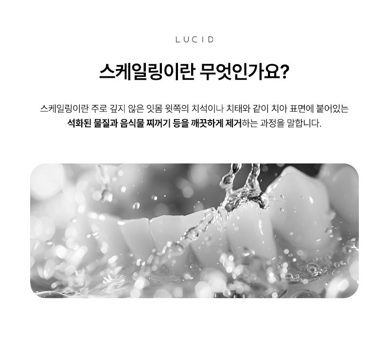 The First Step in Dental Health: Scaling image 3