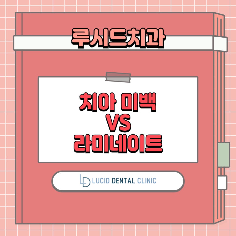 내 치아는 미백 VS 라미네이트 어떤 걸 받아야 될까? - 서초동 치과 의 구강 상식 소개 관련 이미지 1