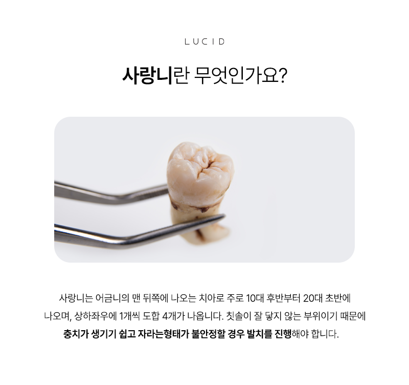 Information You Should Know About Wisdom Tooth Extraction at a Nonhyeon-dong Dental Clinic image 3